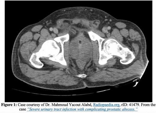 Informations complètes sur la prostatite