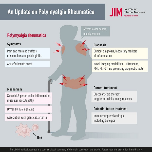 Mise à jour sur la prise en charge de la polymyalgie rhumatismale