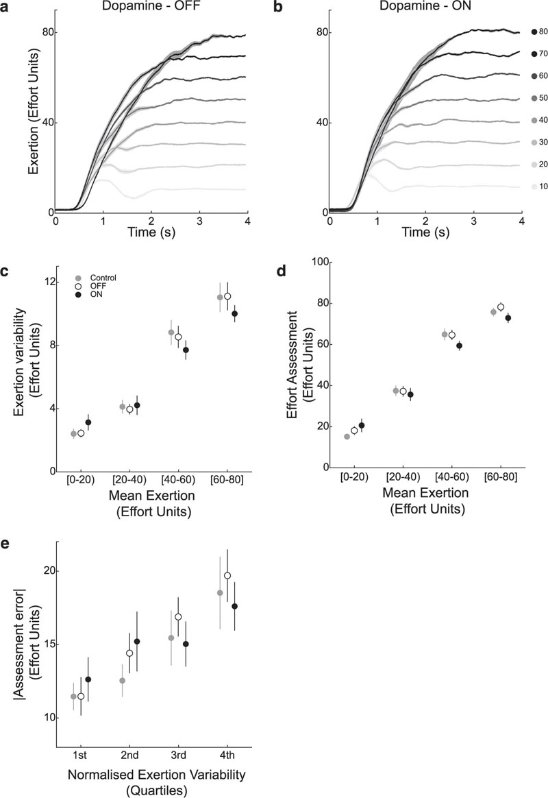 Les niveaux de dopamine influencent la perception de l’E physique